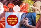 हाई कोलेस्ट्रॉल के लक्षणों को इन संकेतों से समझें आपका शरीर देगा ऐसे संकेत क्या करें ताकि कोलेस्ट्रॉल न बढ़े