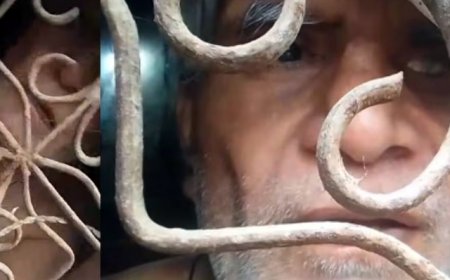 7 सालों से नर्क जैसी जिंदगी! पत्नी की मार से चली गई आंखों की रोशनी, 8 दिन से कमरे में बंद पति